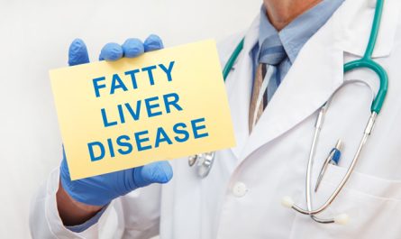 How Doctors Diagnose Fatty Liver Disease