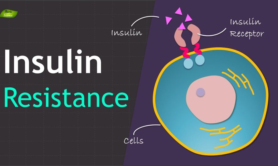 Why Insulin Resistance Is Central to Fatty Liver Disease