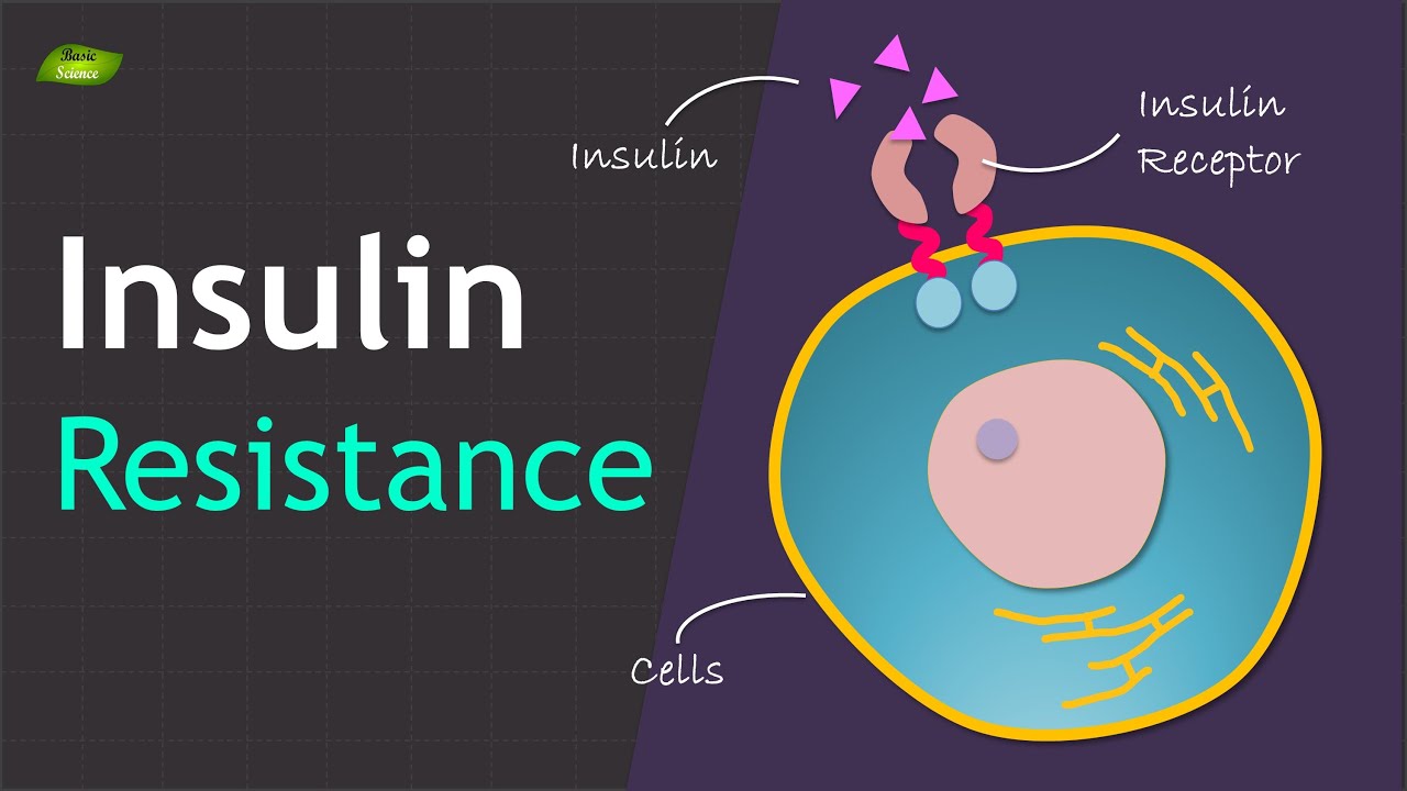 Insulin Resistance