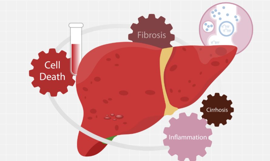 Liver Biomarkers Explained: ALT, AST, GGT, and What They Indicate in Fatty Liver