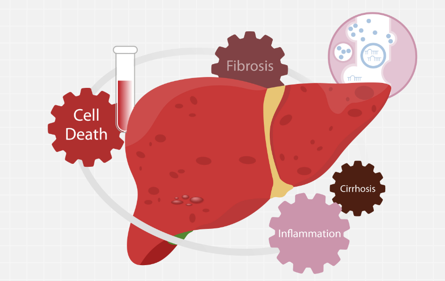 Liver Biomarkers